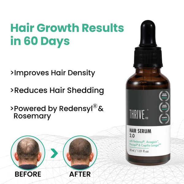 Hair Growth Serum for Men & Women 2.0, 30ML