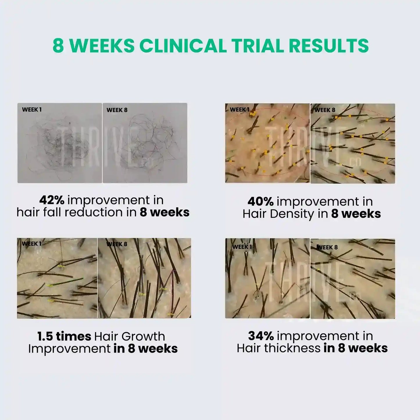 8 weeks clinical trail results of thriveco hair growth serum