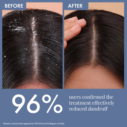 Dandruff Treatment Trial kit