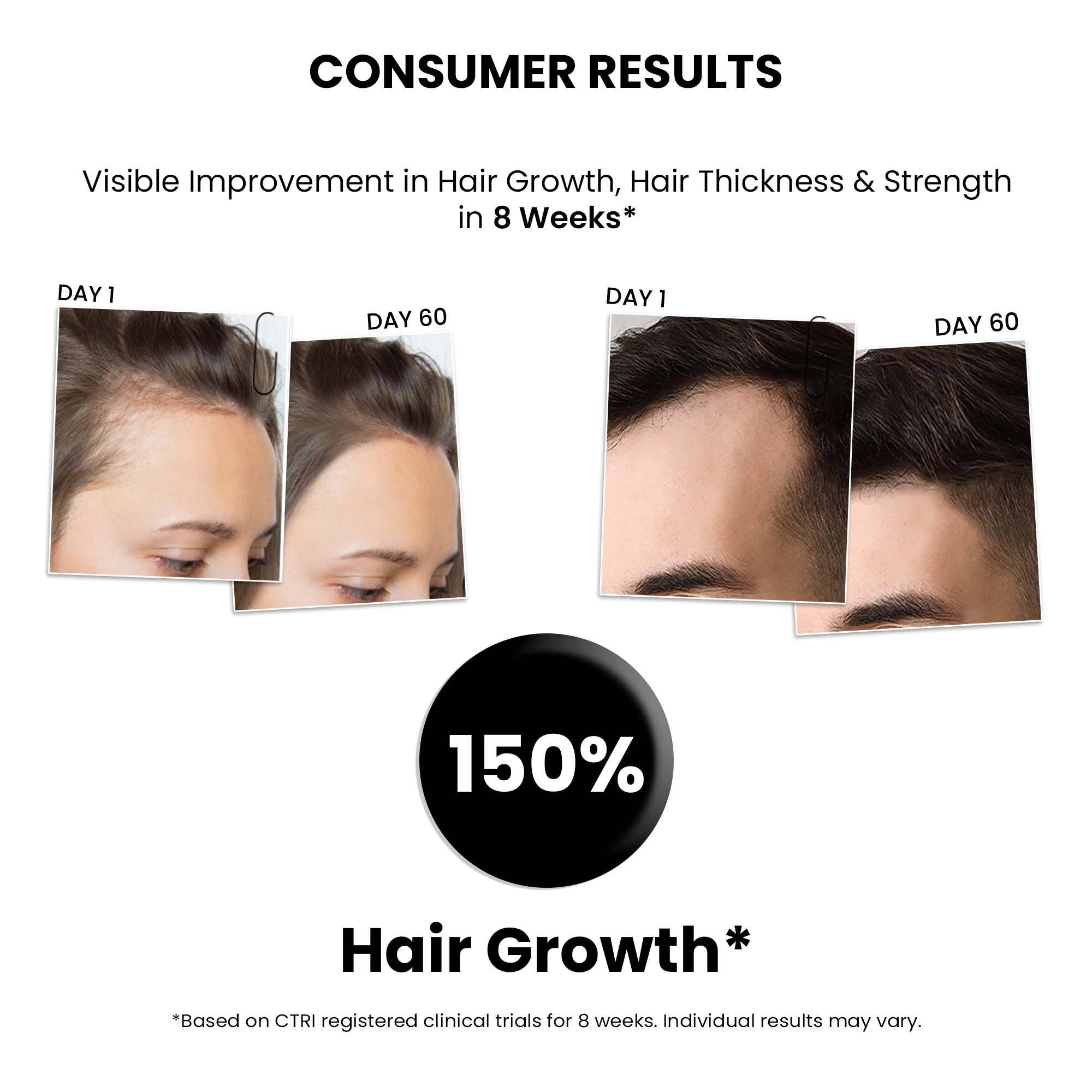 ThriveCo Hair Growth Serum 2.0 For Men & Women | 50ML