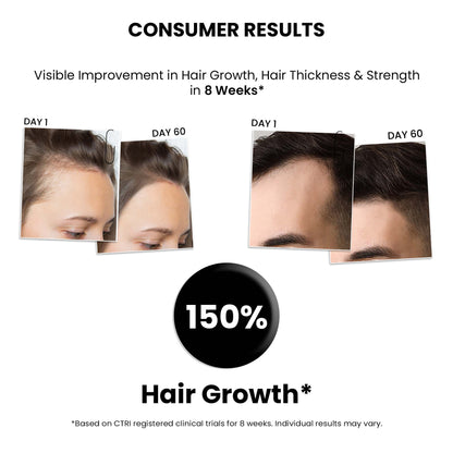 Hair Growth Serum 2.0 For Men & Women