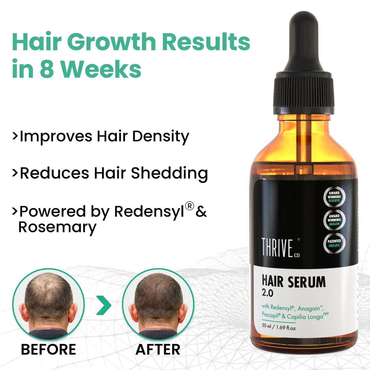 Hair Growth Serum 2.0 For Men & Women, 50ML