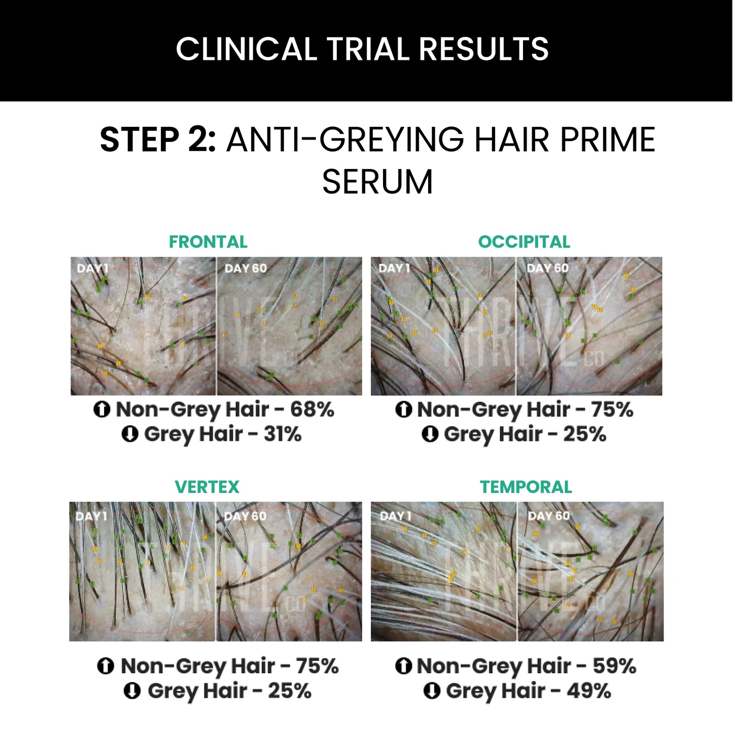 Hair Vitalizing Rosemary Shampoo (250ml) + ThriveCo Hair Prime Serum (50ml)