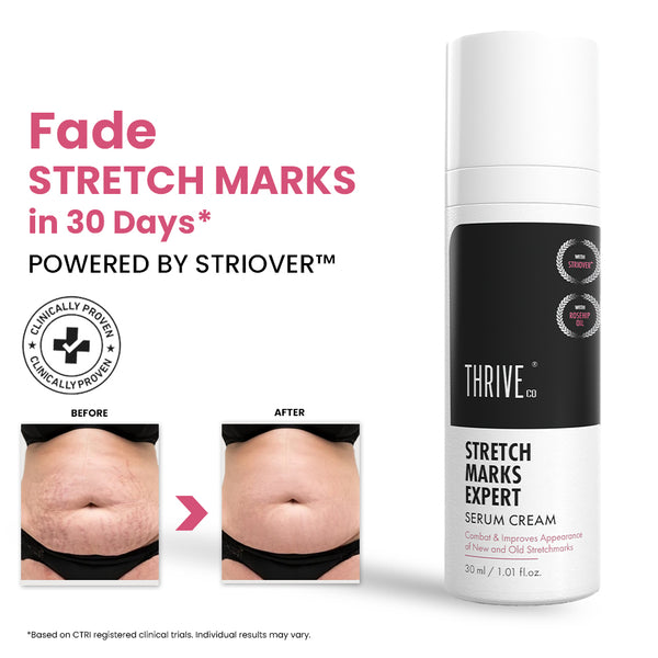 Stretch Marks Expert, Serum Cream 30ml