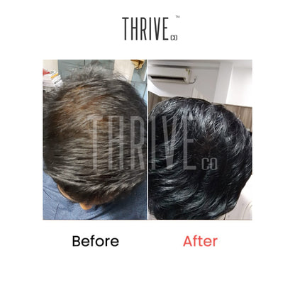 Hair Care Kit: ThriveCo Scalp Scrub (100ml) + Vitalizing Serum (50ml) + Hair Growth Serum (50ml)